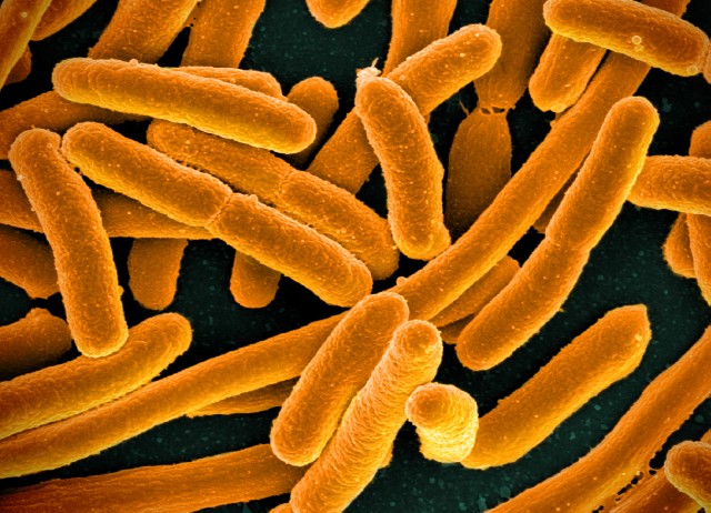 E.coli bacteria